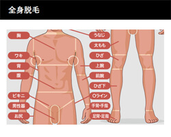 全身脱毛の対応部位